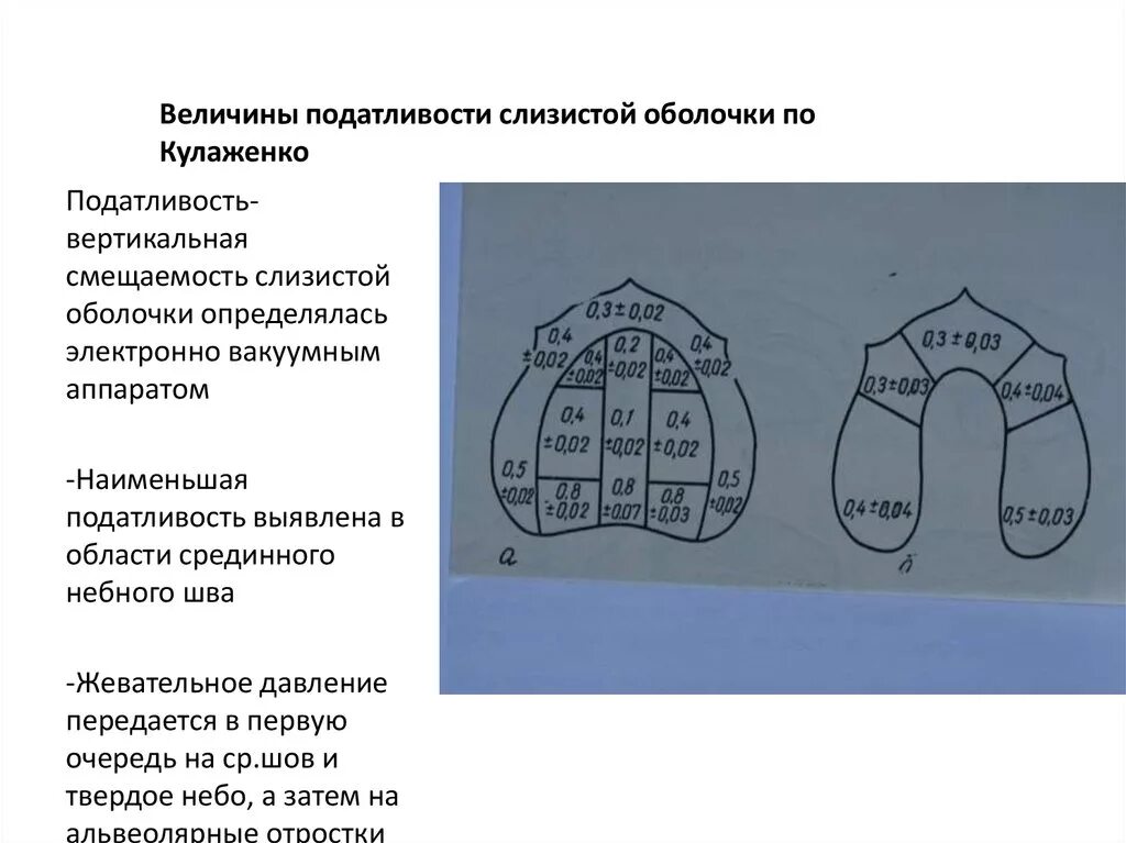 Зоны податливости слизистой оболочки верхней челюсти по Люнду. Классификация слизистой оболочки по Суппле. Топография податливости слизистой оболочки по Люнду.. Податливость слизистой оболочки. Люнд слизистой оболочки