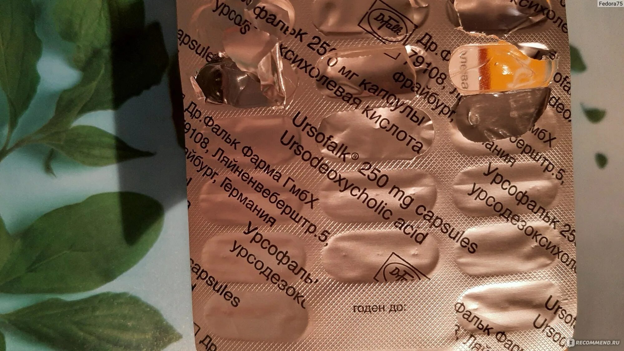 Как жить без желчного пузыря отзывы. Как жить без желчного пузыря отзывы