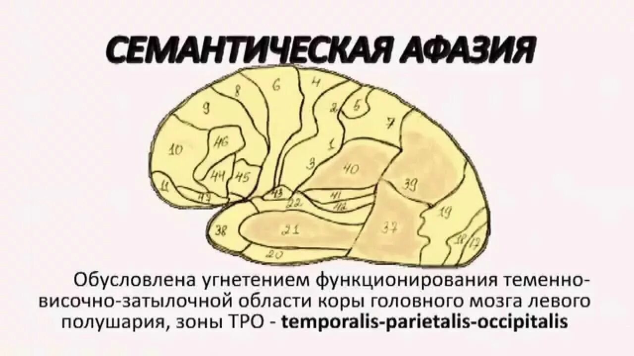 Акустико семантической афазии. Акустико-мнестическая афазия зона поражения. поражение мозга при акустико-мнестической афазии. семантическая афазия зона поражения. семантическая афазия возникает при поражении.