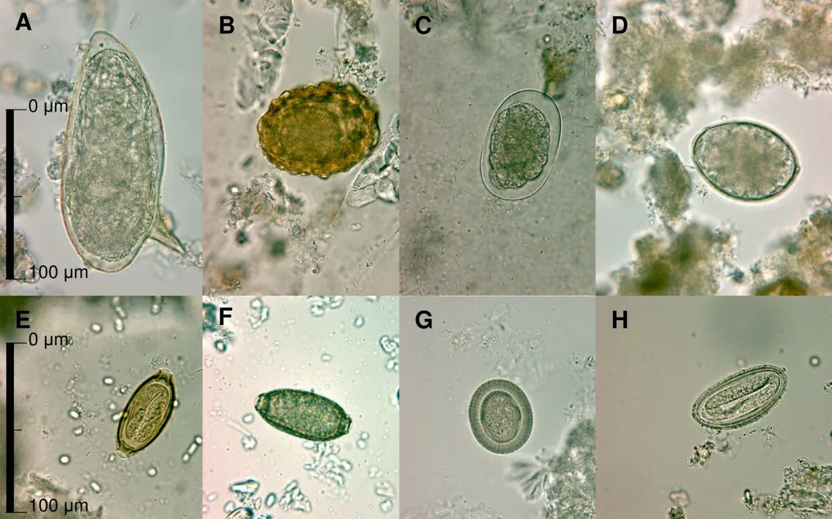 Яйца гельминтов микроскопия. Яйца гельминтов микроскопия атлас. Микроскопия кала яйца гельминтов. Diphyllobothrium latum яйца. Споры в кале у взрослого