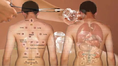 5 Remarkable Healing Benefits Of Cupping Therapy For Your Back, Skin, And Nerves