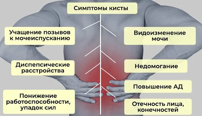 Киста симптомы признаки. Признаки разрывакист кисты разрыва.