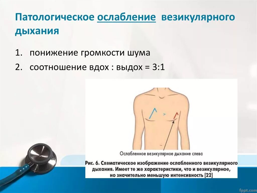 Патологическое ослабление везикулярного дыхания. Аускультация везикулярное дыхание. Ослабленное везикулярное дыхание соотношение. Патологическое усиление везикулярного дыхания.