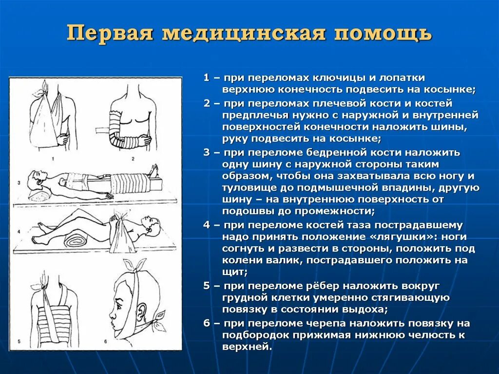 1 помощь при переломе верхней конечности