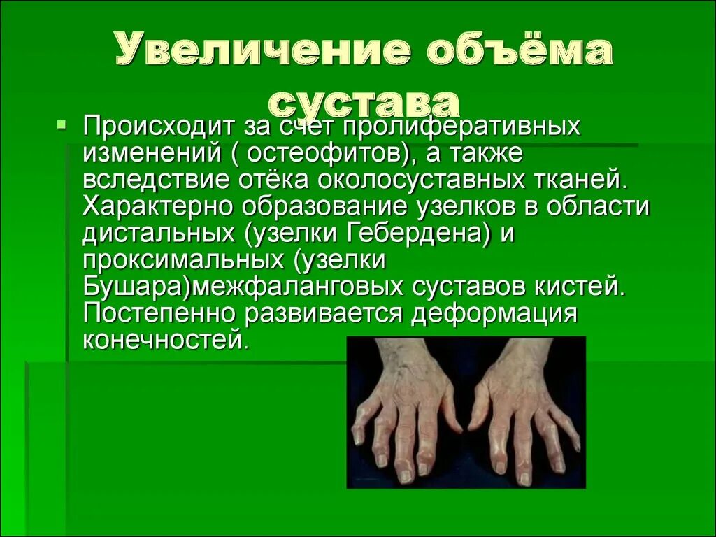 Остеоартрит. Критерии диагностики - презентация онлайн