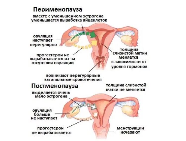 Менопауза перименопауза постменопауза. Перименопауза и постменопауза что это такое. Менструация при климаксе у женщин. При менопаузе в яичниках происходит.