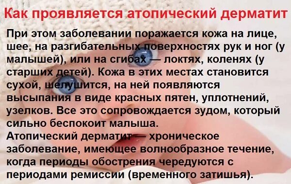 Почему у ребенка дерматит. Атопический дерматит у детей психосоматика причины. психосоматика атопического дерматита у ребенка. атопический дерматит психосоматика у детей. атопический дерматит причины у детей психосоматика заболеваний.