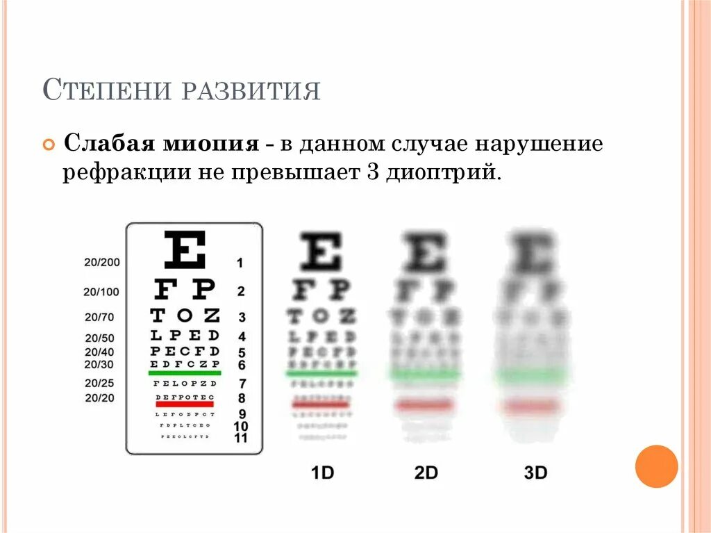 Близорукостью более 6 диоптрий. Миопия степени тяжести таблица. Миопия -7 степень. Миопия слабой степени.