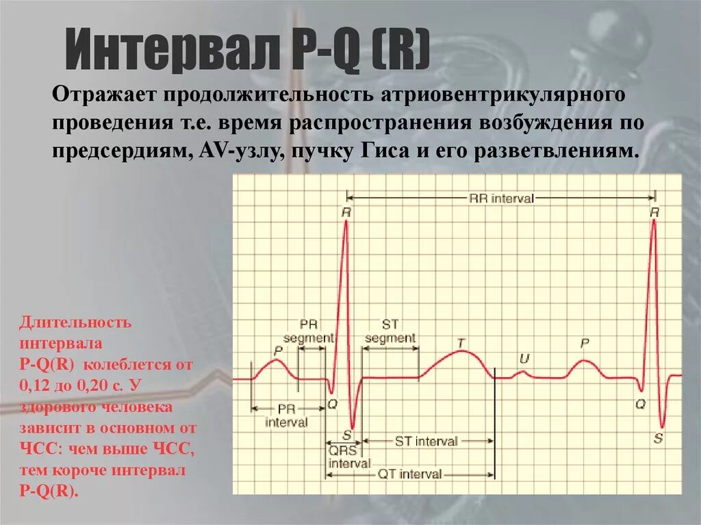 Увеличение интервала pq. Интервал р q на ЭКГ. Продолжительность интервала PQ на ЭКГ. Интервал r r в ЭКГ. Длительность PQ на ЭКГ.