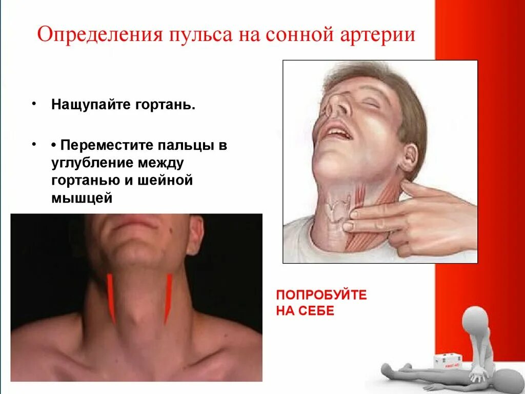 Определение пульса на сонной артерии. Пульсар на сонной артерии. Пульс на сонной артерии определяется. Где находится сонная артерия слева