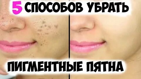 Реальный способ избавиться