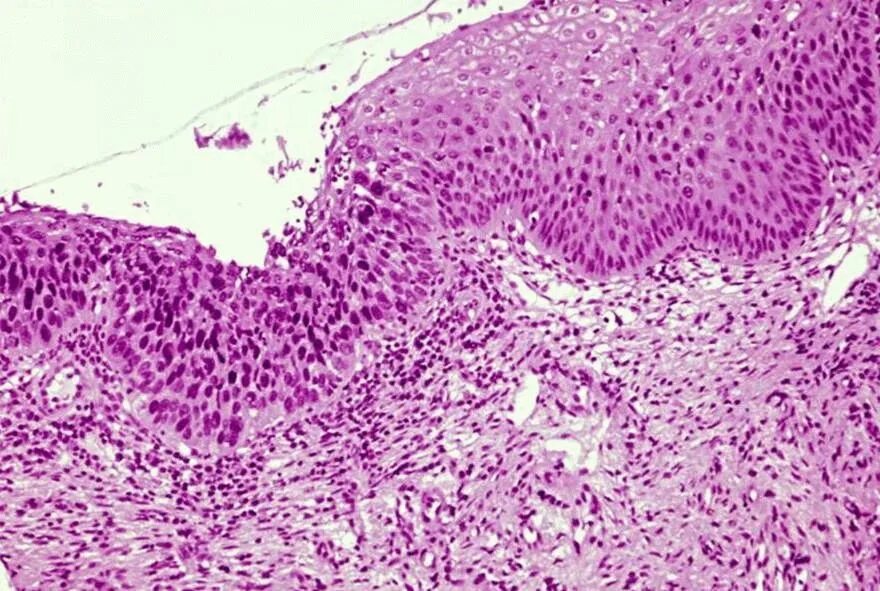 Cin 0