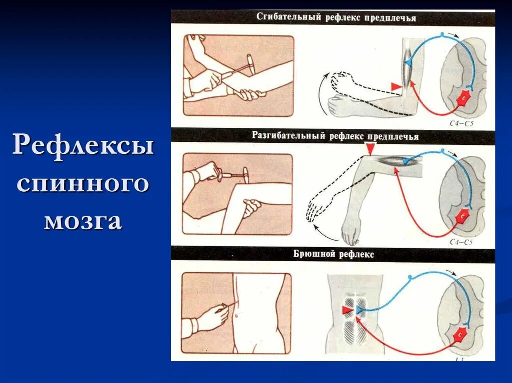 Как проверить рефлексы. Поверхностные брюшные рефлексы. Брюшных и сухожильных рефлексов. Брюшной рефлекс рефлекторная дуга. Глубокие сухожильные рефлексы.