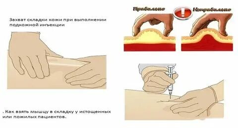 Как ставить уколы подкожно видео. Как ставить уколы подкожно видео