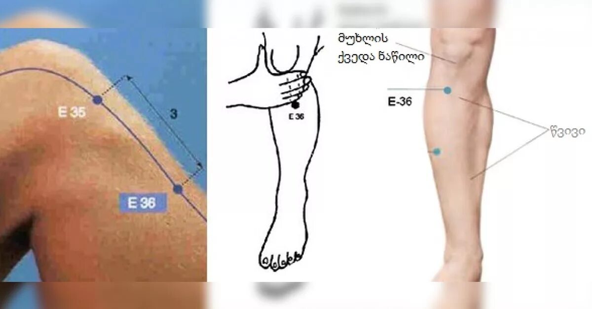 Точка жизни Цзу Сань ли. Цзу-Сань-ли (е36). Точка e36 Цзу-Сан-ли. Точка Цзу Сань ли -36.