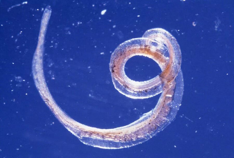 Власоглав это. Власоглав геогельминт. Власоглав человеческий (Trichocephalus Trichiurus). Трихоцефалез – власоглав. Круглые черви паразиты власоглав.