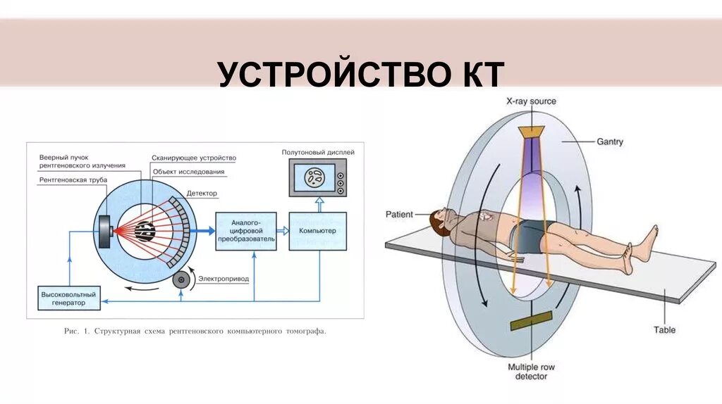 Работа аппарата. Основные компоненты магнитно резонансного томографа. Принцип работы магнитного резонансного томографа. Принцип работы магниторезонансного томографа. Конструкция мрт томографа.