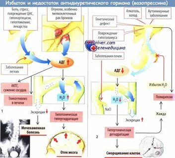 К чему приводит недостаток вазопрессина