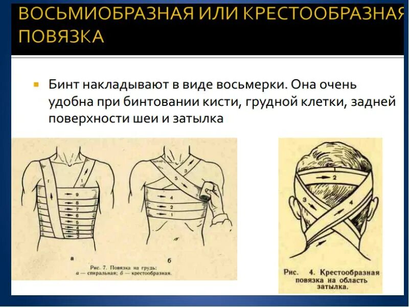 Инструментальная перевязка. Виды перевязок. Хирургические перевязки. Перевязка трахеостомы алгоритм. Перевязки виды перевязок.