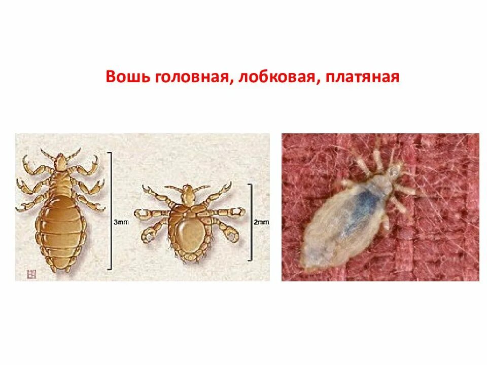 Вошь платяная (Pediculus humanus humanus. Головная и платяная вошь под микроскопом. Головные вши и платяные вши. Платяная вошь строение рисунок. Самка головной вши рисунок