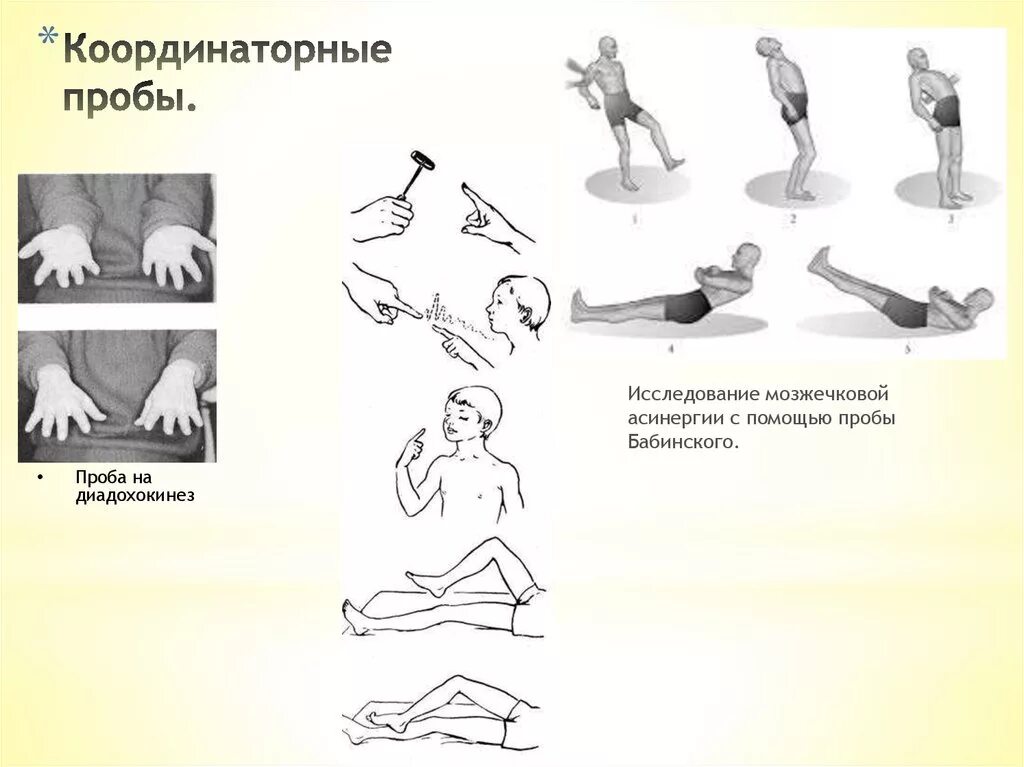 Проба тойбера. Координаторные пробы. проба на диадохокинез. координациоонве проба. пробы для исследования мозжечка.