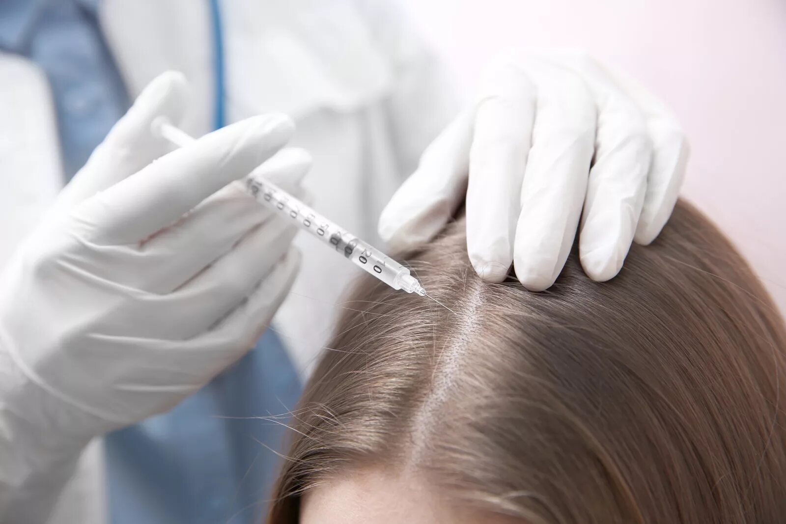 Инъекции головы. Мезо волосистой части головы. Hair treatment мезотерапия. PRP плазмотерапия для волос.