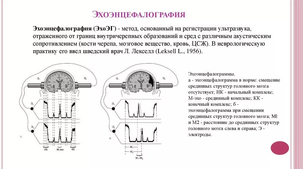 Изменения срединные структуры