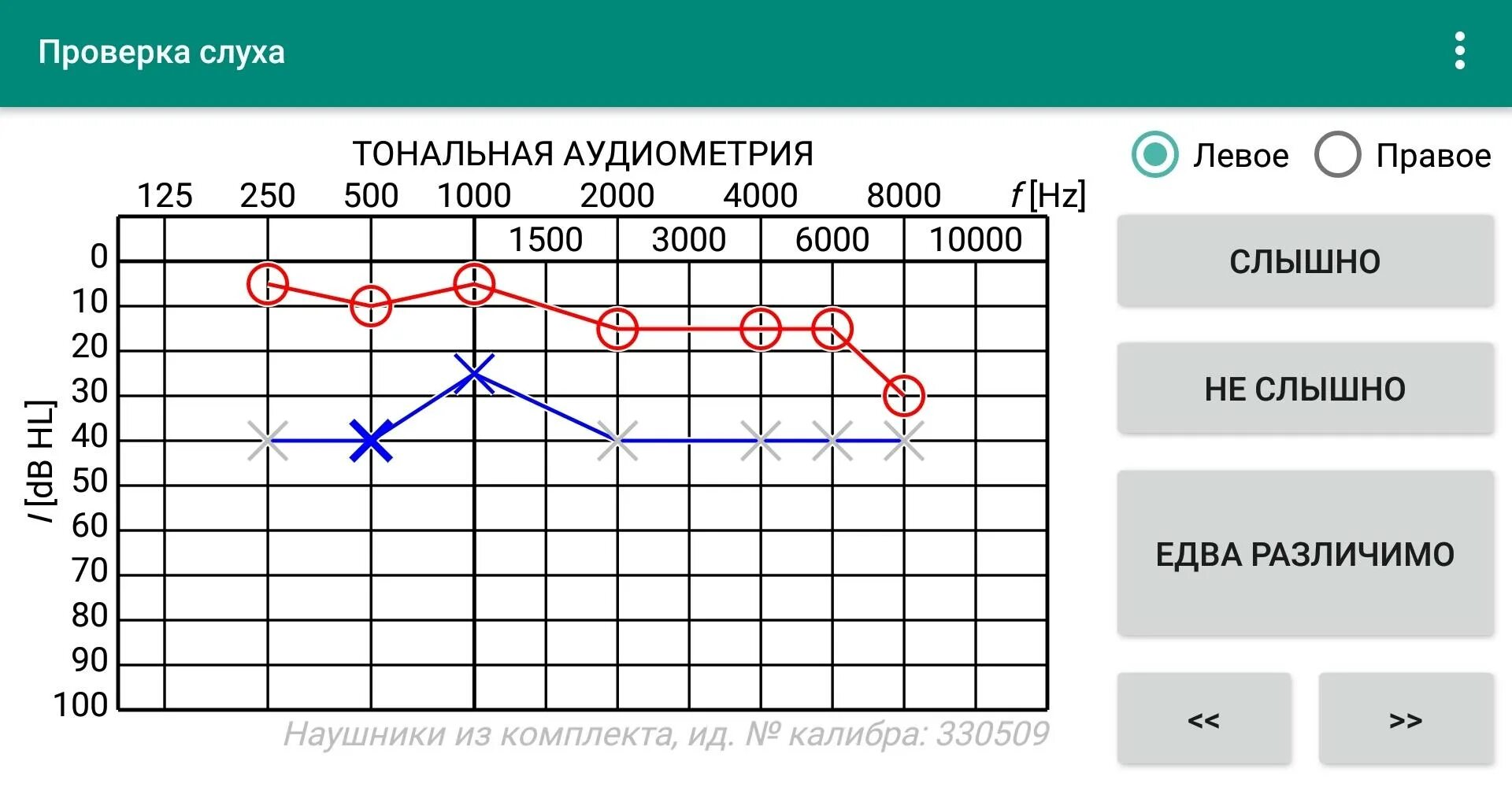 Спидометр для проверки слуха. Аудиограмма в спб