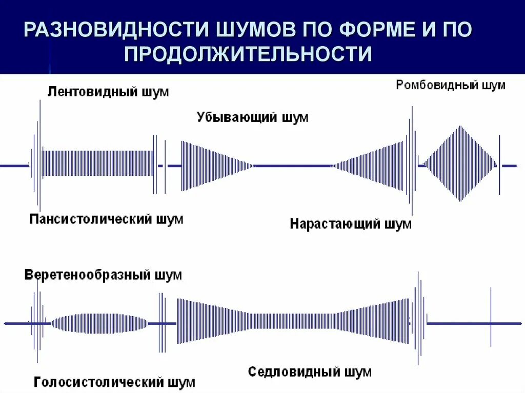 Виды гуди