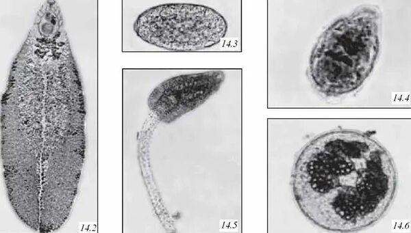 Дигенетические сосальщики личинка. Легочный сосальщик. Яйца легочного сосальщика. Кровяной сосальщик строение. Выделение сосальщиков