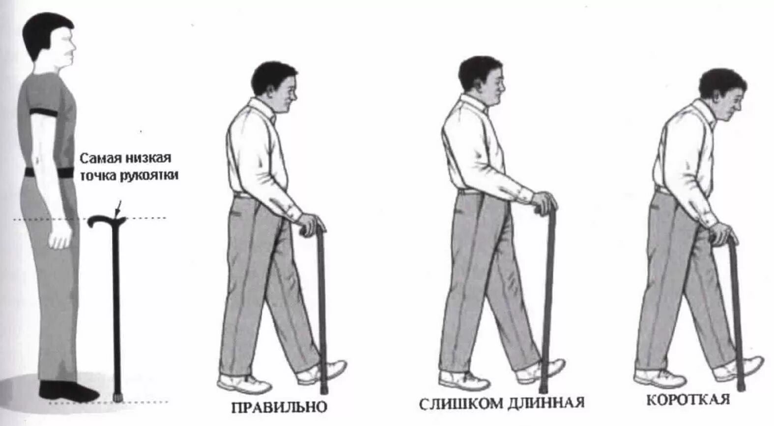 Сколько нужно ходить на костылях после эндопротезирования. Трость после эндопротезирования тазобедренного сустава. Трость для опоры при ходьбе. Трость для ходьбы после перелома. Хождение с тростью.