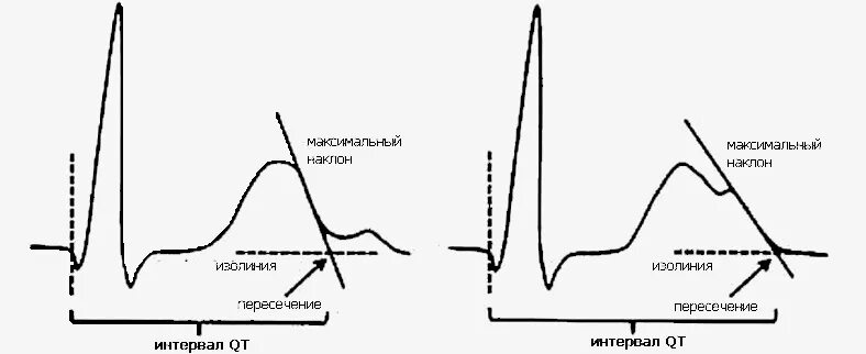 Удлиненное qt на экг. Интервал qt на ЭКГ. Измерение интервала qt. Измерение интервала qt на ЭКГ. Удлинение интервала qt на ЭКГ.