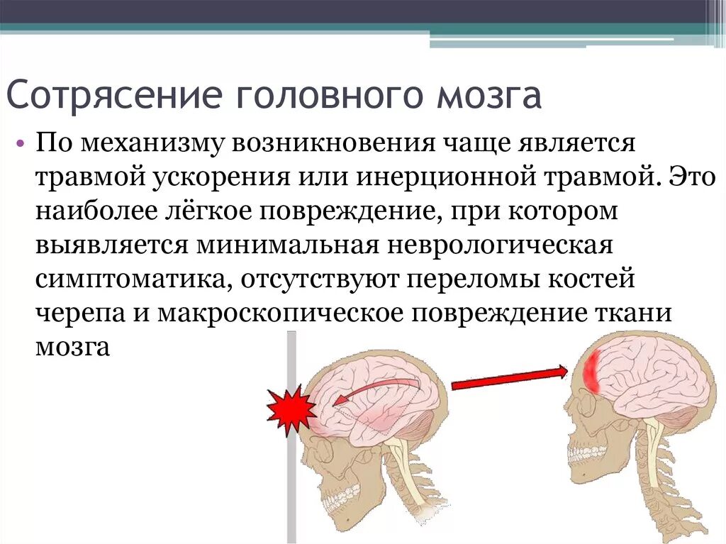 Царапина по сравнению с сотрясением мозга