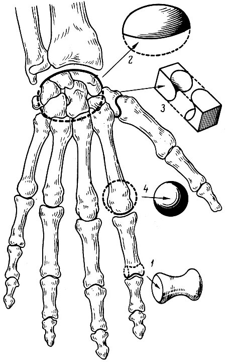 Почему кости легкие. Блоковидный сустав это в анатомии. Шаровидные блоковидные кости. Блоковидное соединение сустава. Эллипсовидные и седловидные суставы.