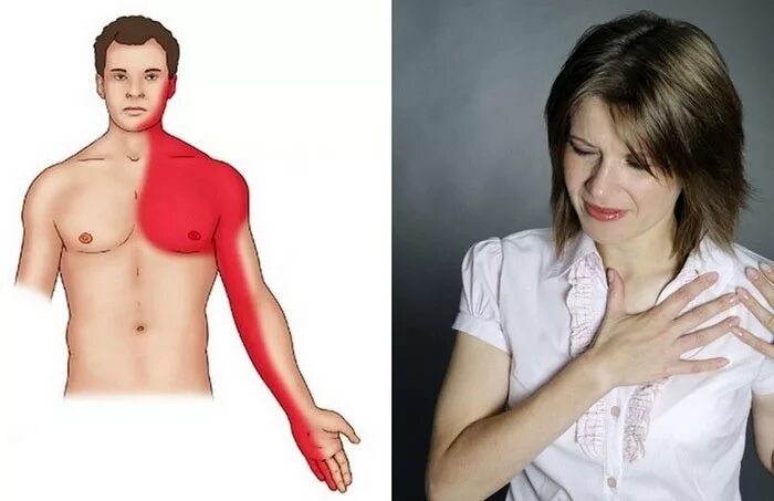 Боль в грудной клетке. Боль с левой стороны грудной клетки. Болит левая сторона грудной клетки. Боль слева над грудной клеткой. Мужчина справа женщина слева