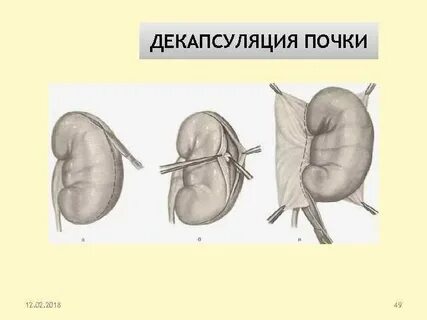 Почка 12