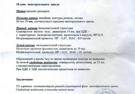 Эхо фаза