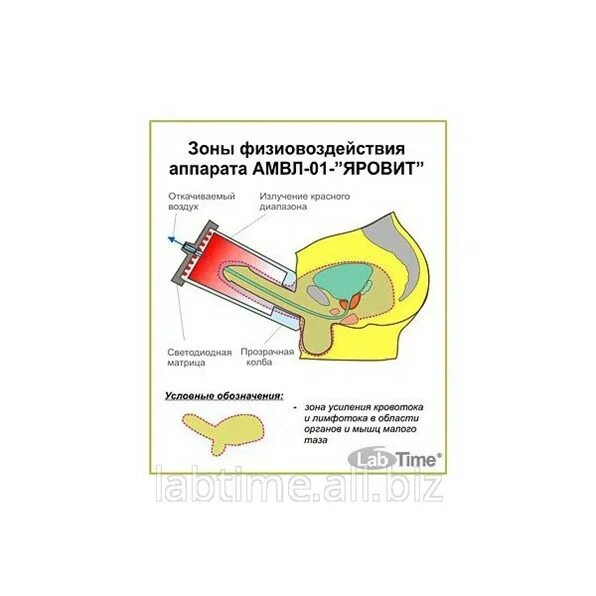 Лод терапия в урологии. Прибор яровит процедура. локальная декомпрессия в урологии.