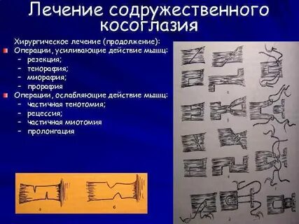 Продолжение операции