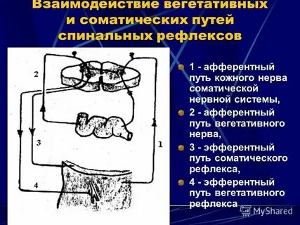 Т система необходима