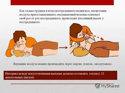 Перерыв между давлением на грудину пострадавшего