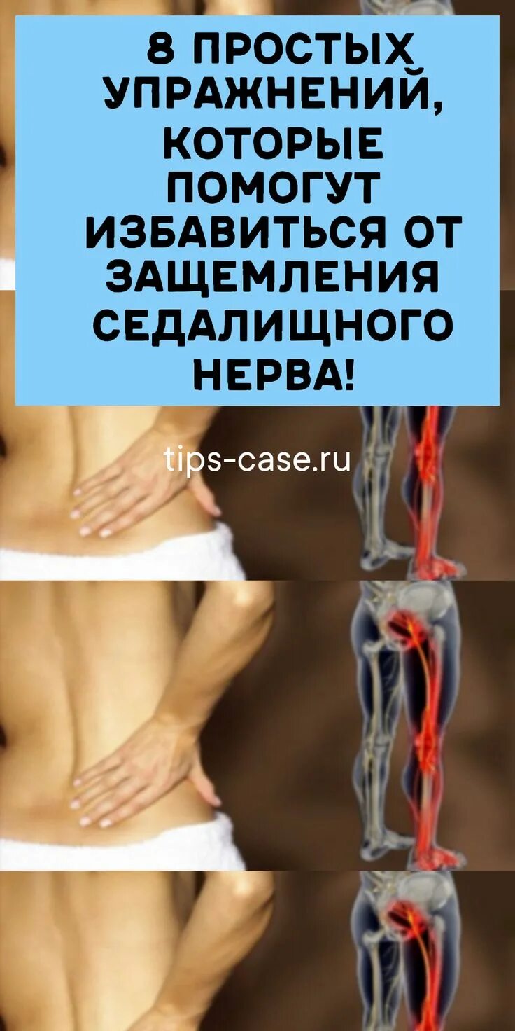Защемление седалищного нерва! Сделай СРОЧНО и станет гораздо легче! - YouTube