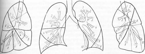 Сегментарное строение легких на кт. Сегменты легких топографическая анатомия. Сегментарное строение легких рентген. Сегменты легкого на кт анатомия. Покалывание левого легкого