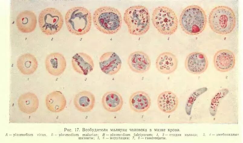 Трофозоит малярийного плазмодия. Шизонты малярийного плазмодия. Plasmodium falciparum шизонт. Гаметоцит малярийный плазмодий.