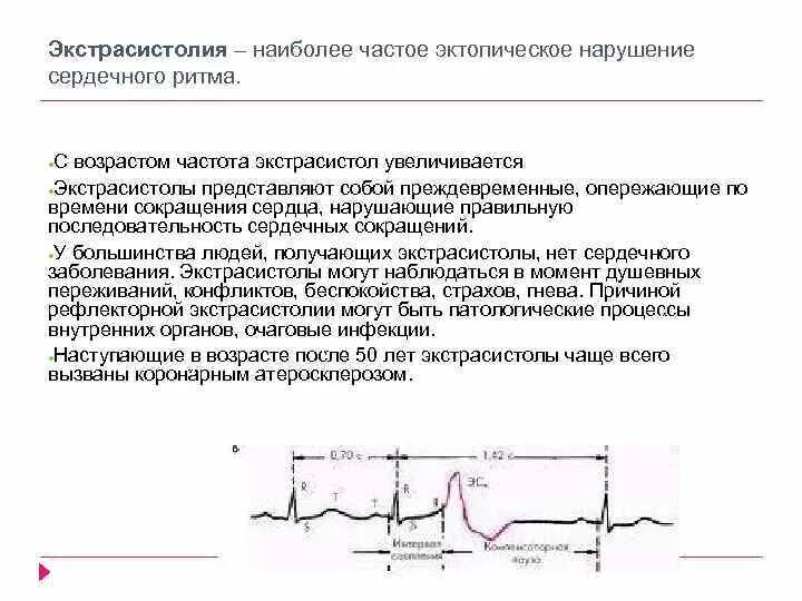 Ощущаю экстрасистолы. Экстрасистолы причины. частые экстрасистолы. причины экстрасистолии. функциональные экстрасистолы.