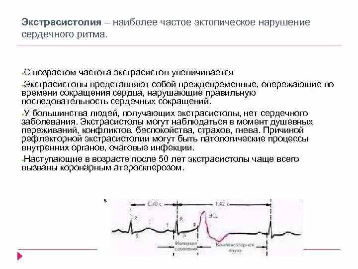 Экстрасистолия физиология. После экстрасистолы наступает фаза. Графики экстрасистолы. Эктопическая экстрасистолия. Экстрасистолы врачам