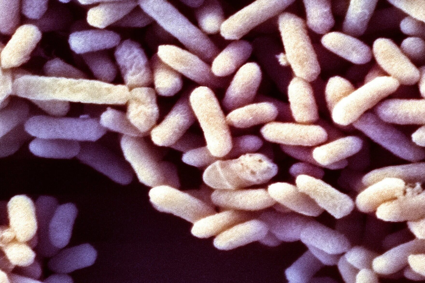 Палочка бифидобактерии. Бифидобактерии longum. Бифидобактерии инфантис. Бифидобактерии бифидум под микроскопом. Bifidobacterium bifidum под микроскопом.
