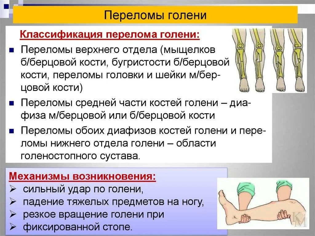 Признаки переломов у детей. Классификация переломов диафиза голени. переломы диафиза костей голени классификация. переломы костей голени презентация. закрытый перелом верхней трети голени.