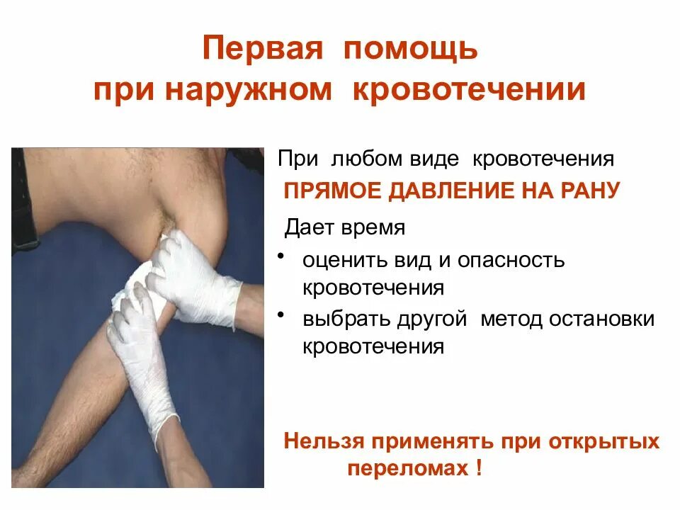 1 помощь при открытом кровотечении. При оказании первой помощи при наружном кровотечении необходимо. первая помощь при кровотечениях. первая помощь при наружных кровотечениях. первач посощь при наоужных кровотечениях.