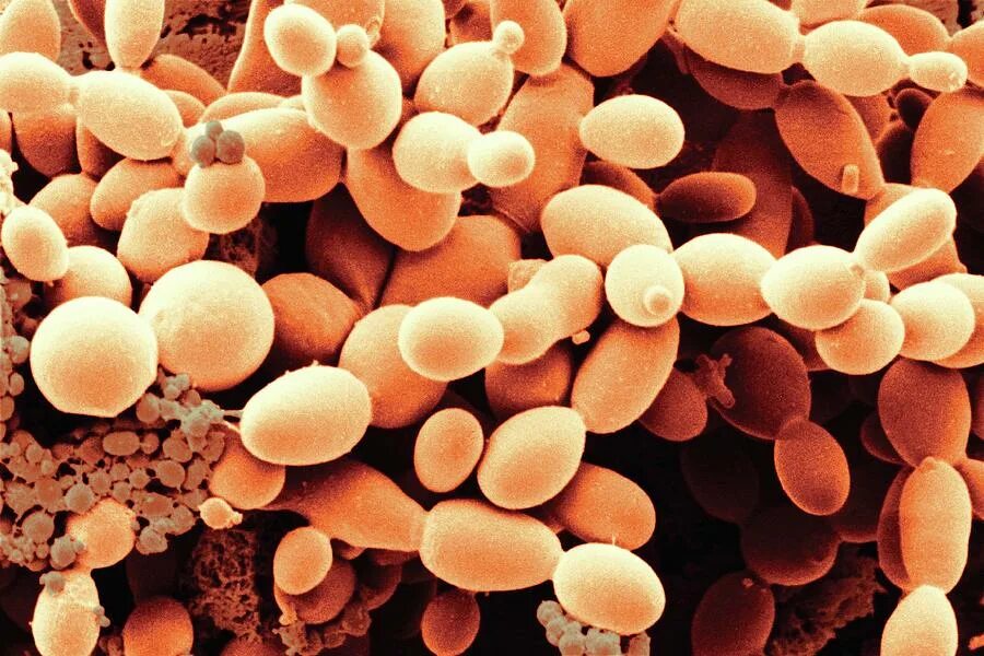 Грибы в биотехнологии. Saccharomyces cerevisiae под микроскопом. Дрожжи Saccharomyces cerevisiae. Дрожжи Saccharomyces cerevisiae под микроскопом. Дрожжи Хефе микроскоп.